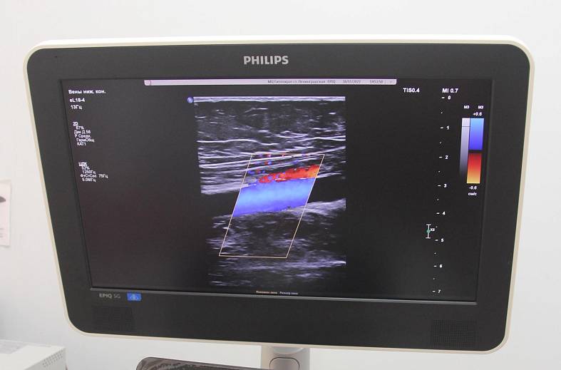 Эндовенозная лазерная коагуляция - ЭВЛК одной магистральной вены нижней конечности (Аппарат лазерный хирургический "MedLase S")