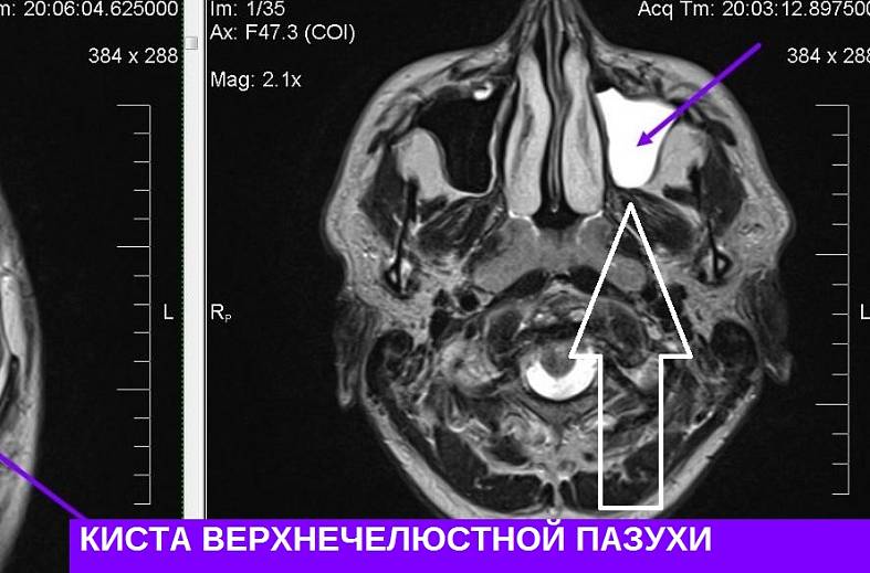 МРТ головного мозга (обзорное)