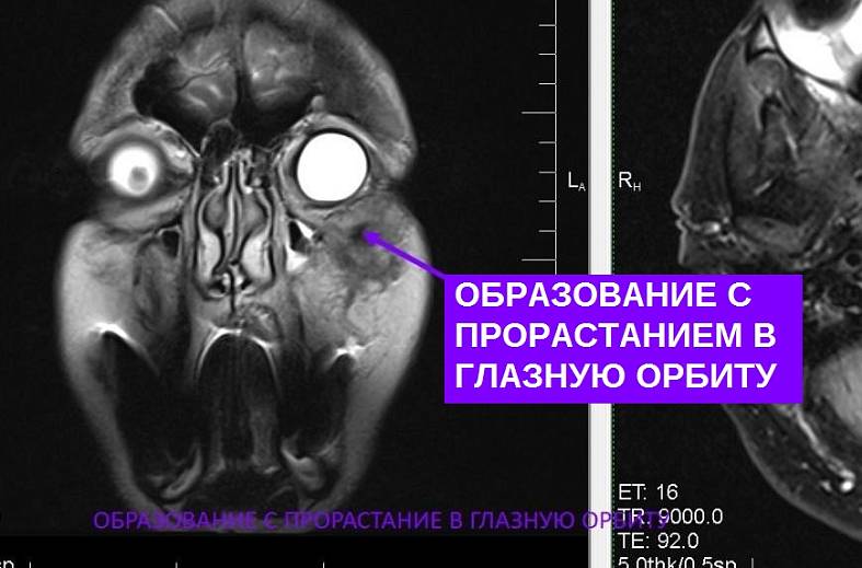 МРТ головного мозга (обзорное)