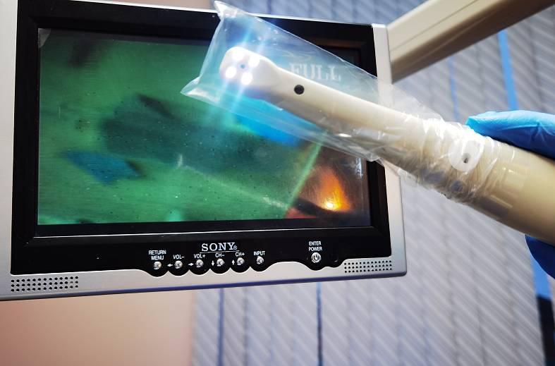 Первичный прием стоматолога с диагностикой интраоральной видеокамерой 