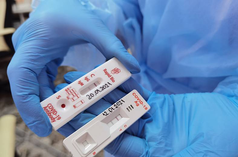 Тест на коронавирус методом ИХА выявление антител G и M к коронавирусу в крови пациента (Сколково,Россия)(появляется в течение первой недели от начала инфекции), готов 15 минут